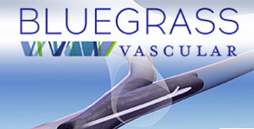 BLUEGRASS VASCULAR TECHNOLOGIES TO COMMERCIALIZE ITS MEDICAL DEVICE