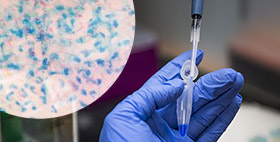 Texas Biomed Researchers Pinpoint link between HIV and Tuberculosis
